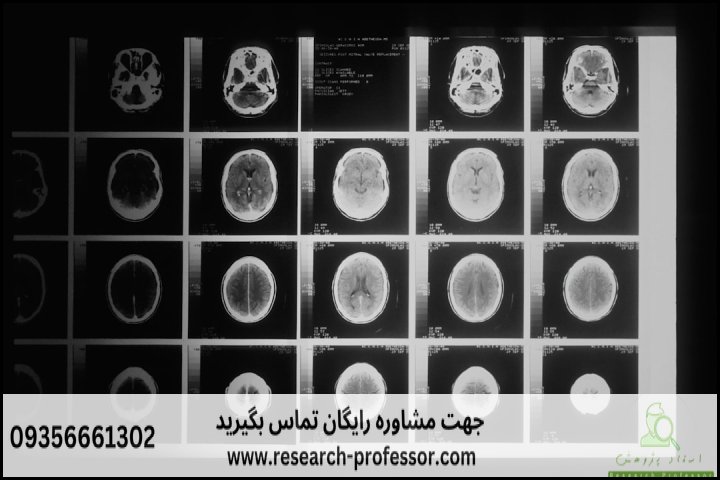 انجام پروپوزال رشته روانشناسی علوم شناختی — تصویر 3